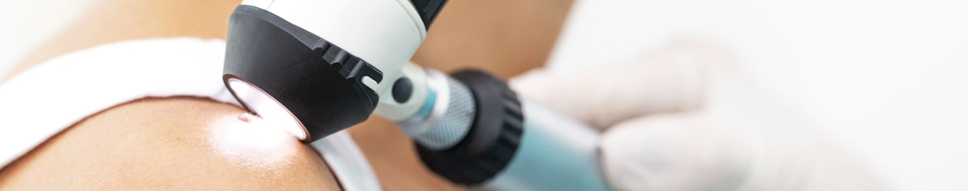 dermatologist inspecting mole