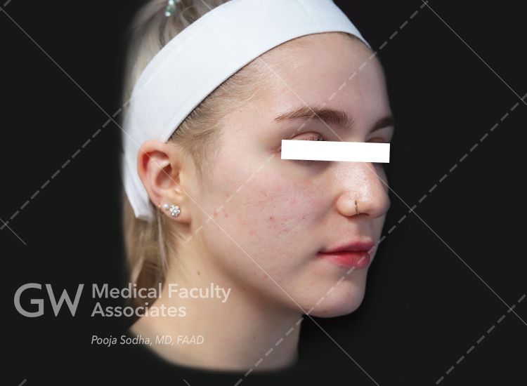case three post-treatment