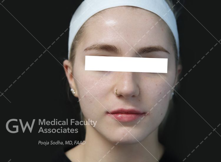 case three post-treatment