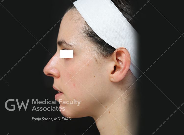 case three post-treatment