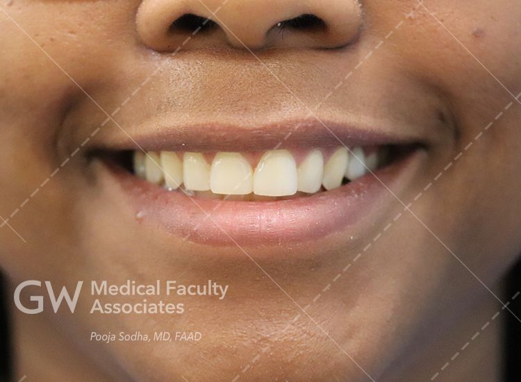 case 5 post-treatment