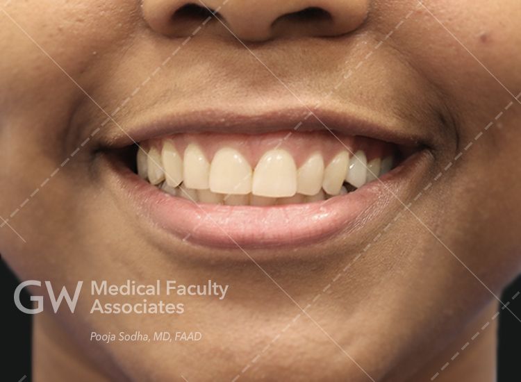 case 5 pre-treatment