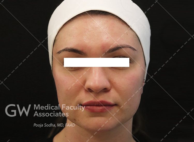 case 12, post-treatment