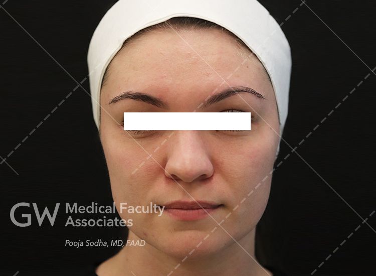 case 12, before procedures